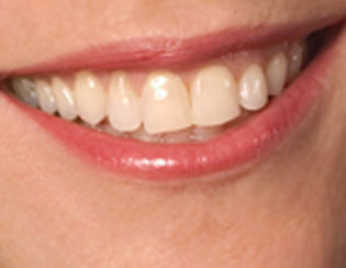 Can you match the famous Philly grin with its owner?