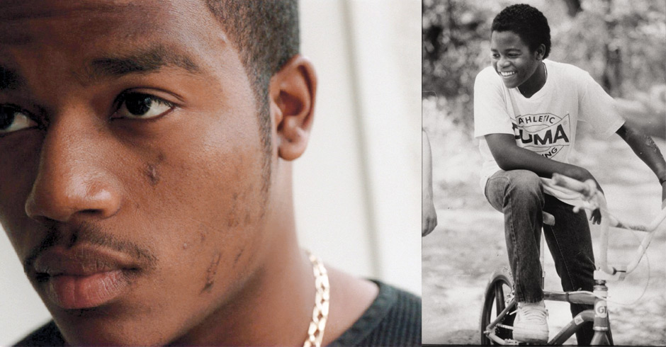 Left: Mike some 10 years after the Osage Avenue disaster, still sporting the scars from his ordeal. Right: Birdie, renamed Mike, looking happy and healthy just shy of 16 years old, May 1988.