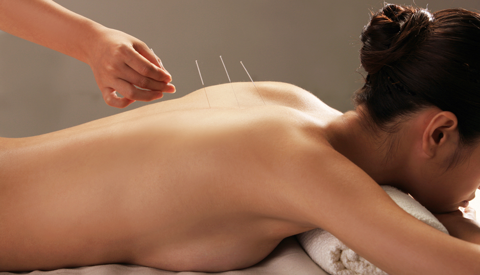 Acupuncture