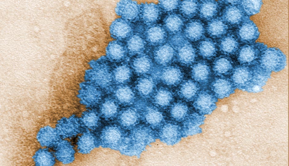 Norovirus. Image | NIH