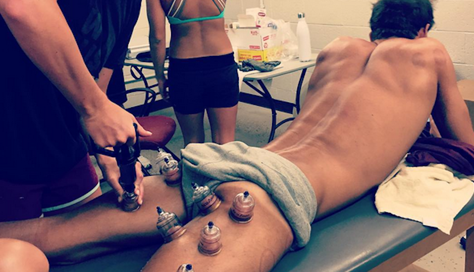 Michael Phelps in a cupping session | Photo via Instagram