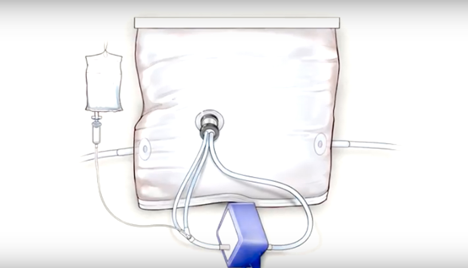 An illustration of the womb-like device 