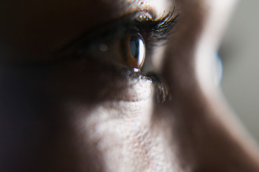 biolattice artificial cornea